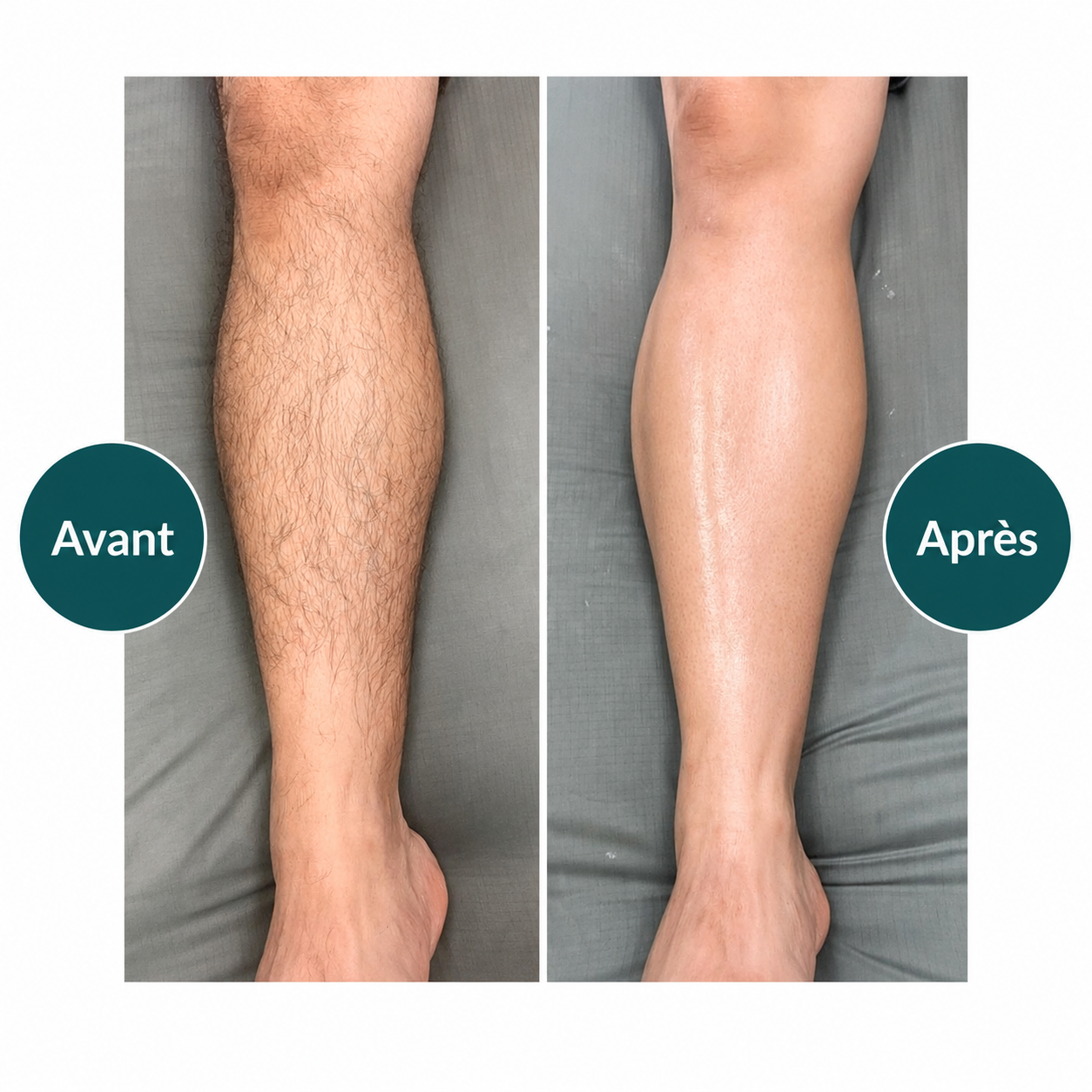 Crème dépilatoire en spray